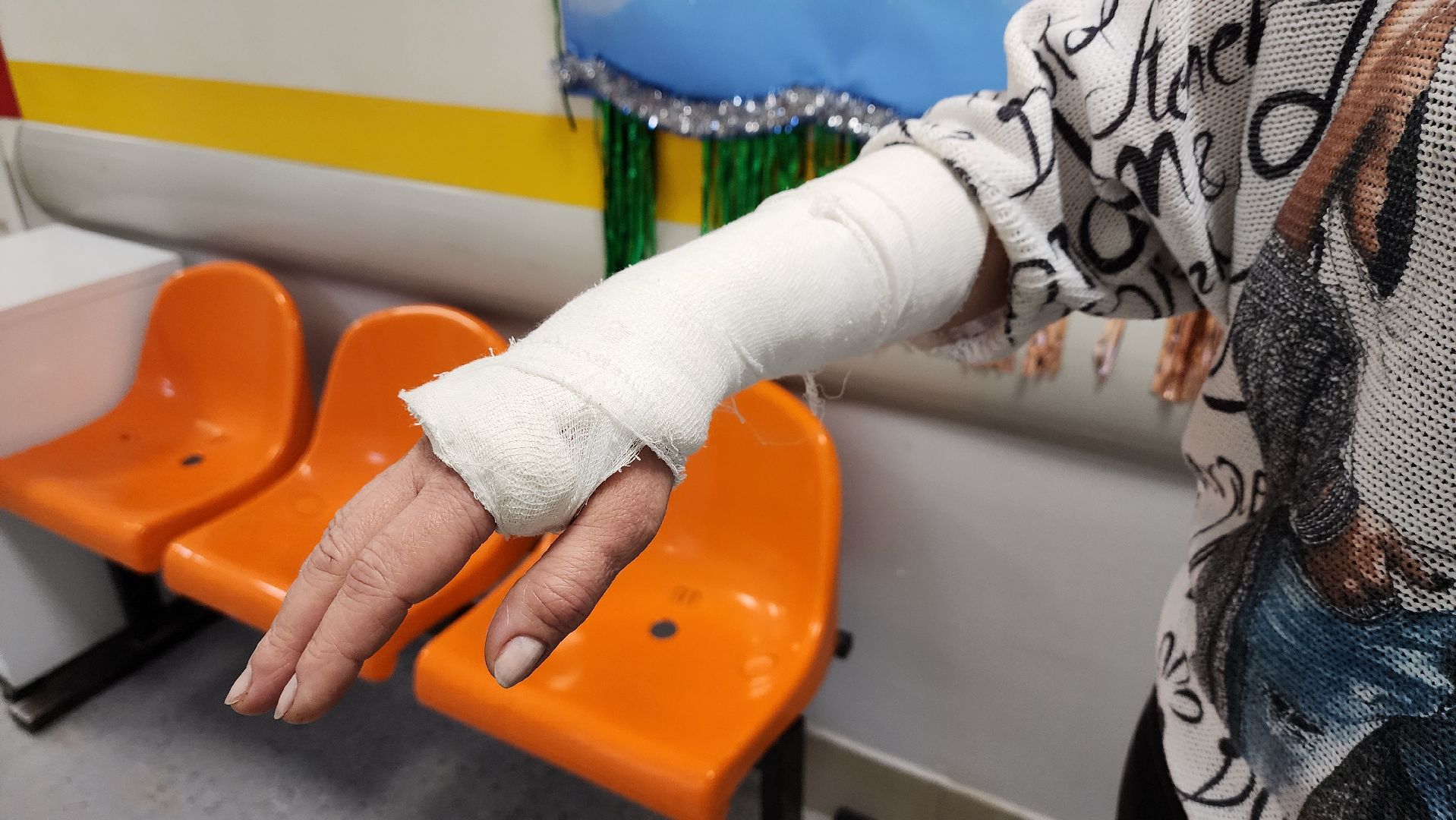 Солнечногорск, медицина, травматология, гололед,