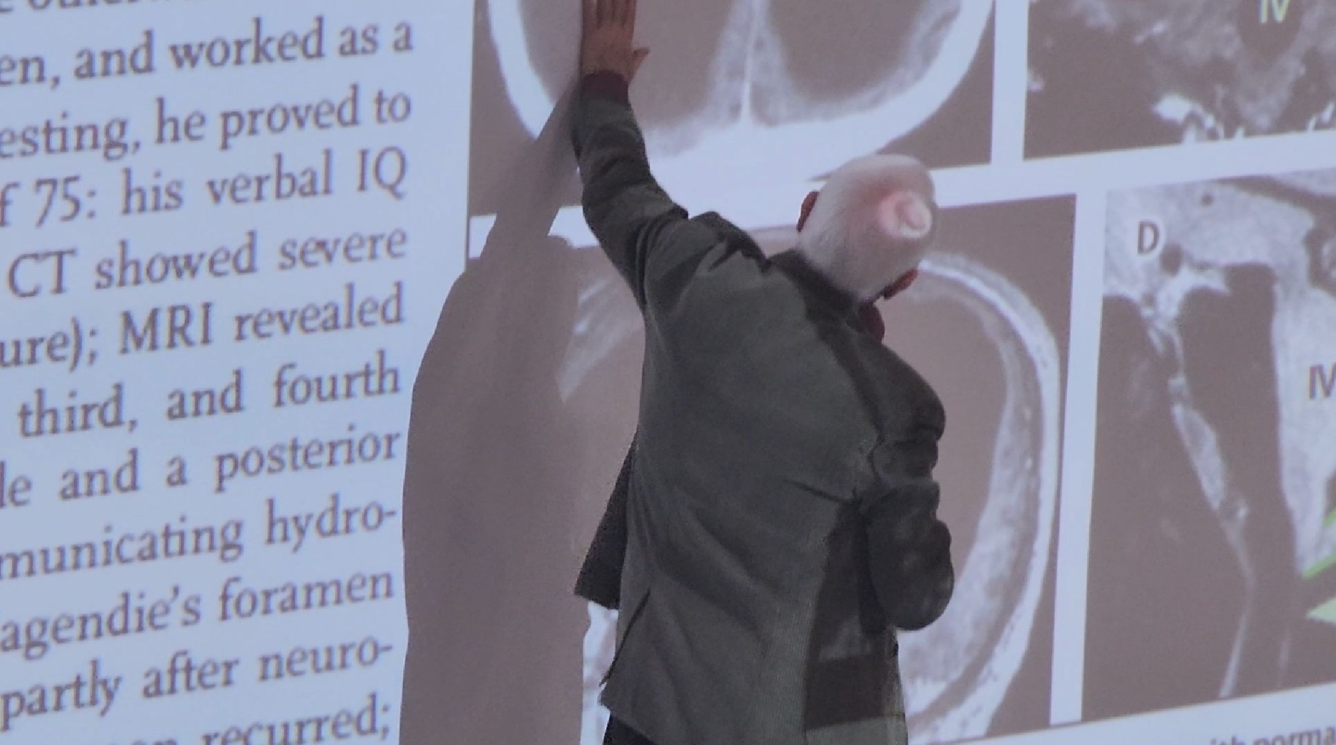 долгопрудный, физтех-лицей, технопарк, александр каплан, научный лекторий, тайны мозга, вертикалки,