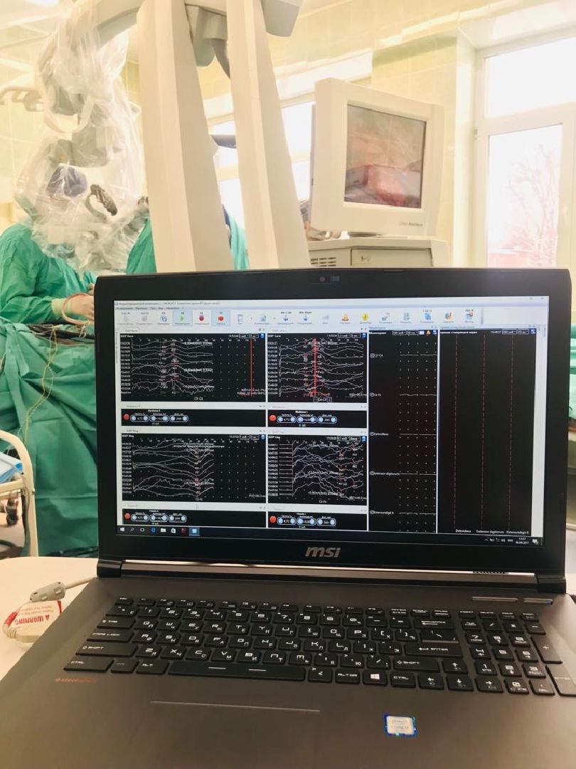 Нейрохирург, высокотехнологичные операции, медицина