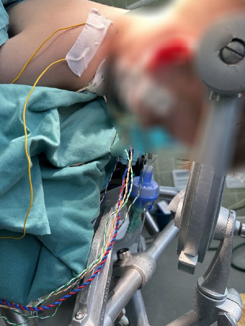 Нейрохирург, высокотехнологичные операции, медицина