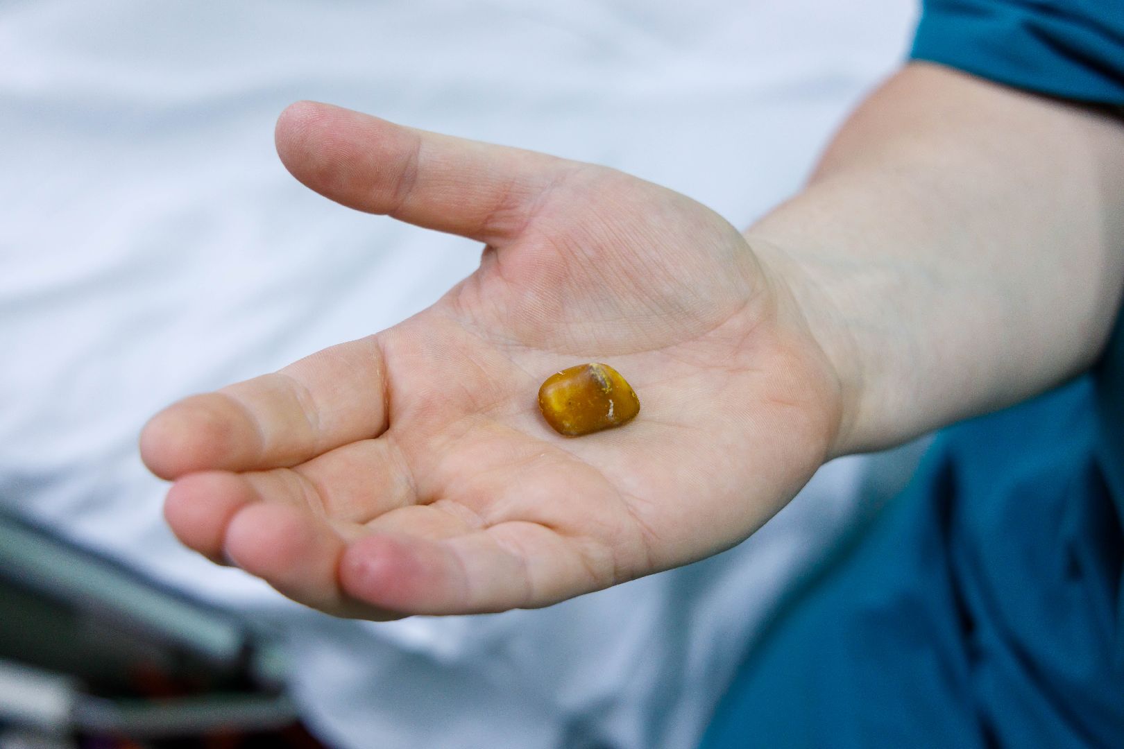 люберцы, люберецкая больница, малоинвазивные операции,