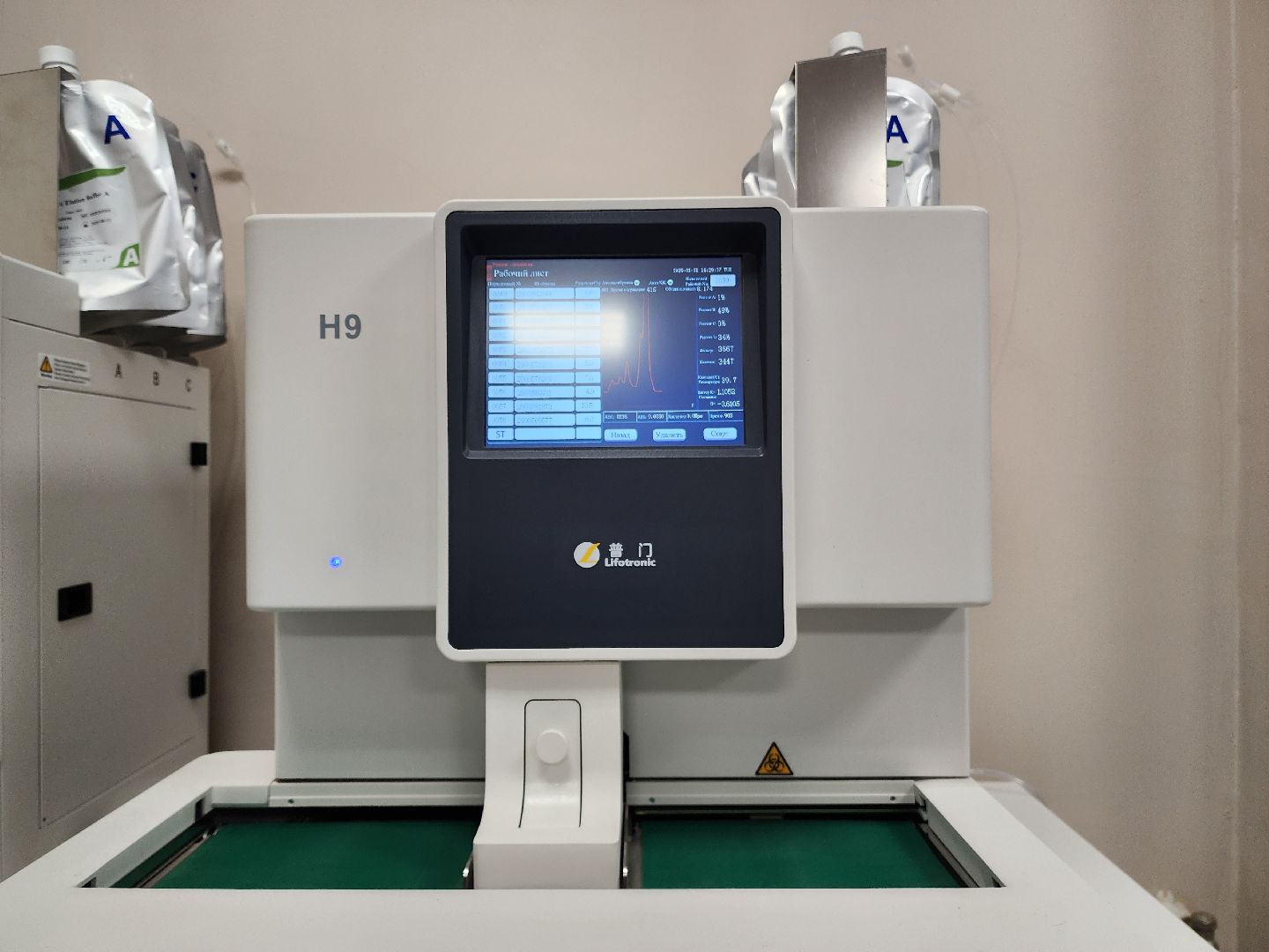 раменское, медицина, новое оборудование,