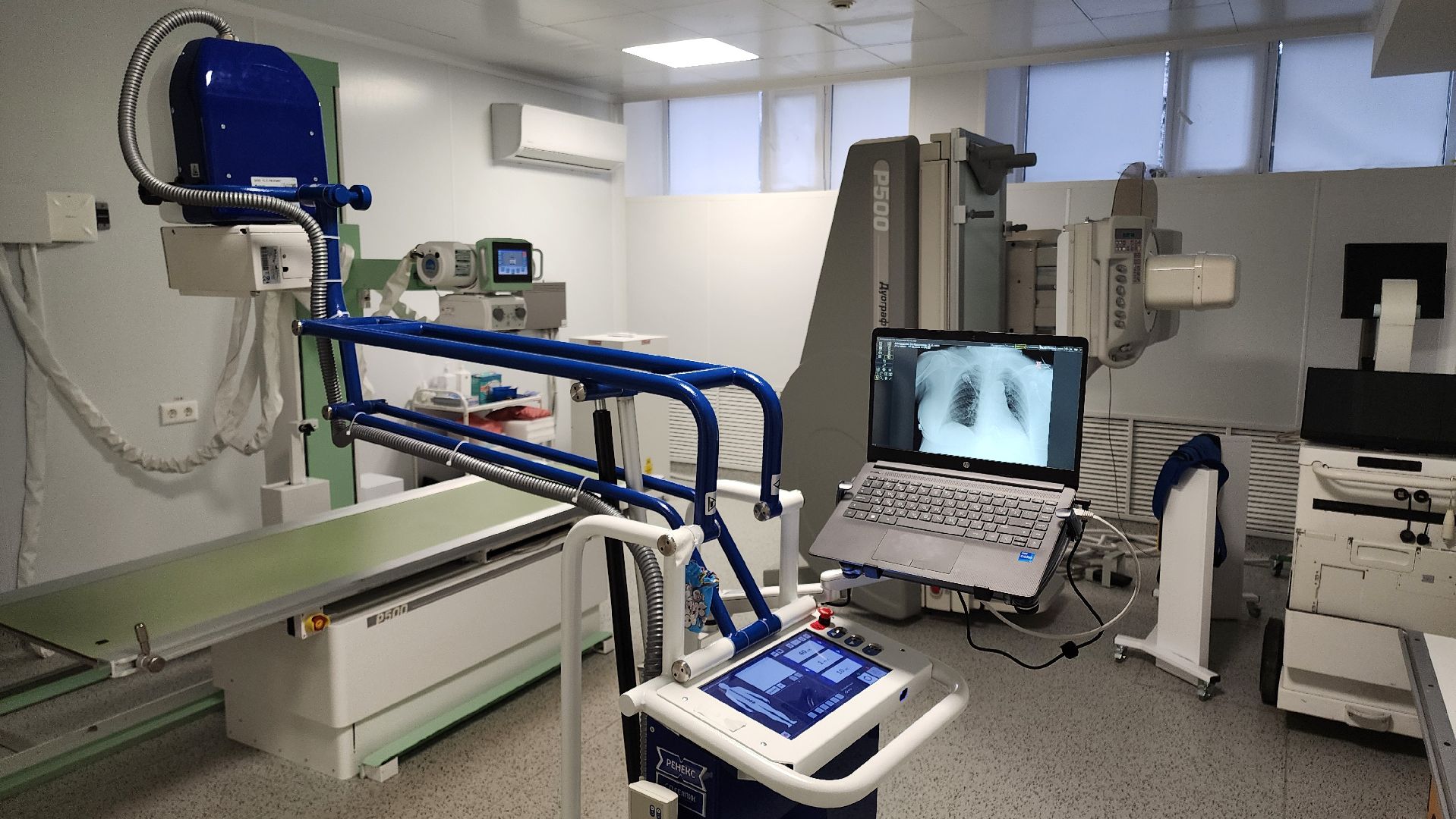 кашира, больница, рентген-аппарат, цифровое оборудование, хирургия, вертикалки,