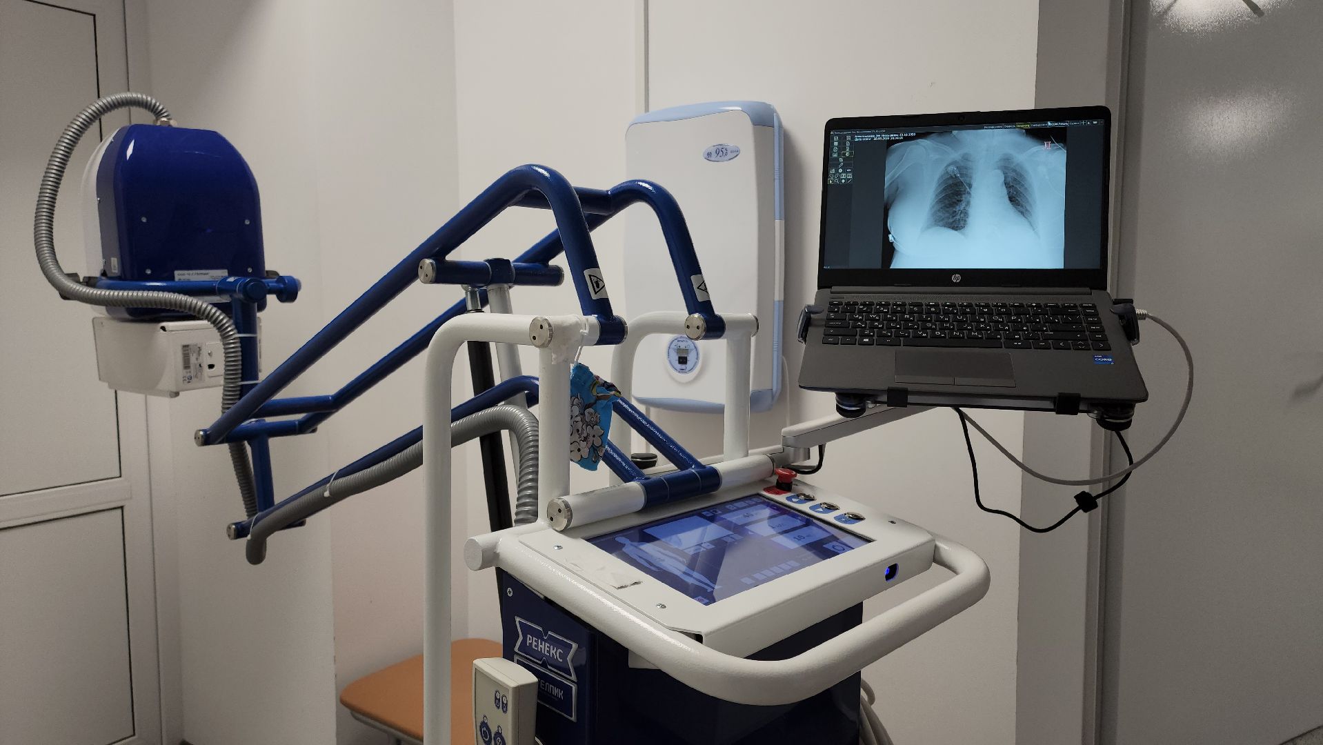 кашира, больница, рентген-аппарат, цифровое оборудование, хирургия, вертикалки,