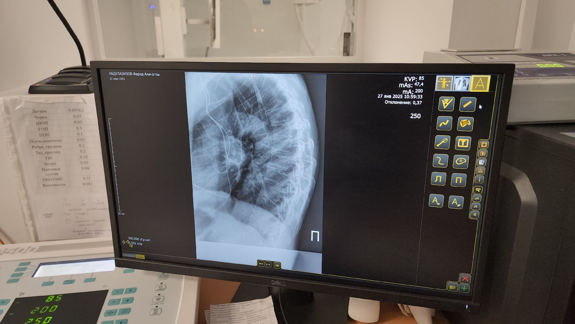 кашира, больница, рентген-аппарат, цифровое оборудование, хирургия, вертикалки,