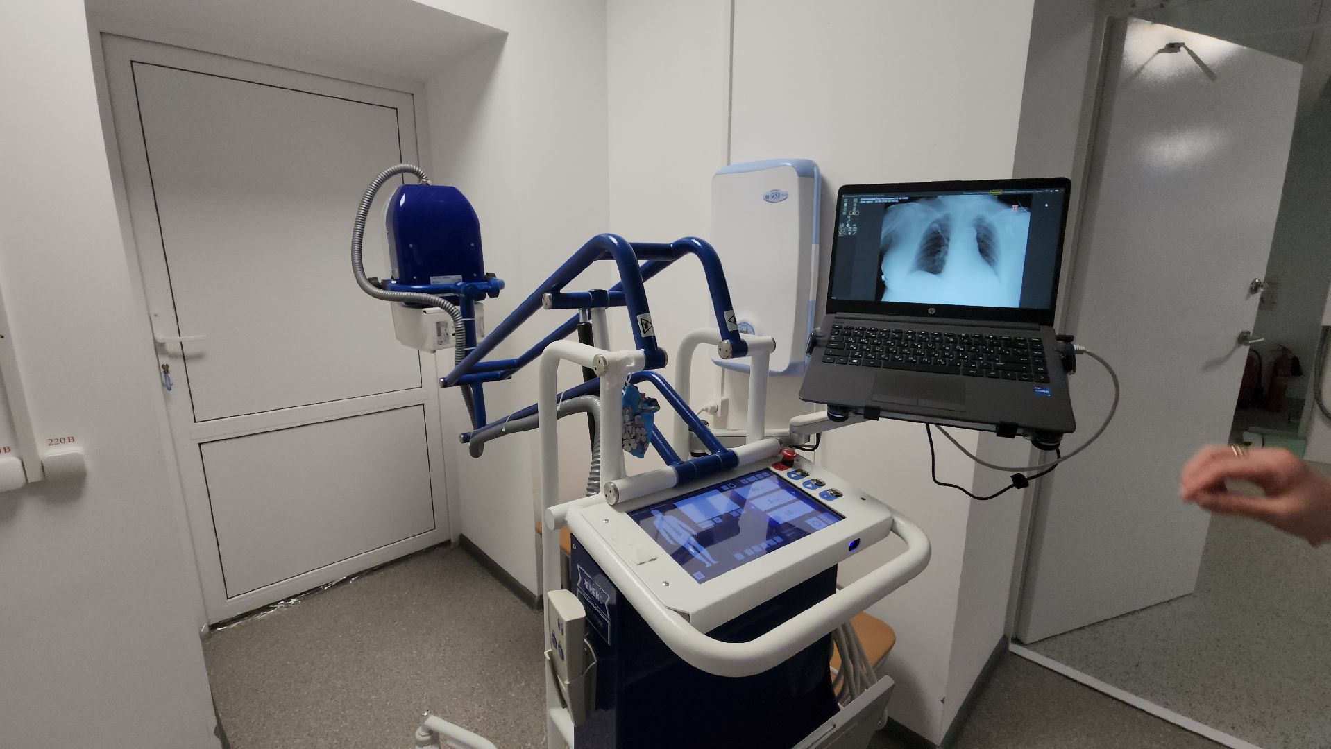 кашира, больница, рентген-аппарат, цифровое оборудование, хирургия, вертикалки,