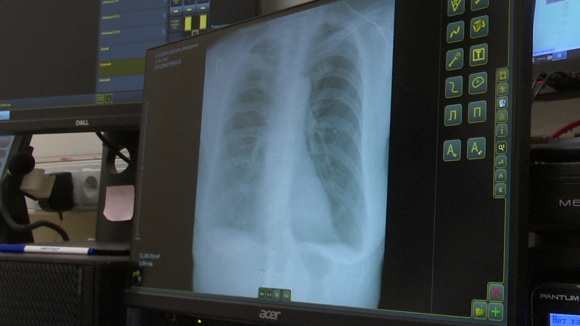 реутов, вертикалки, здравоохранение, искусственный интеллект, анализы, рентген,