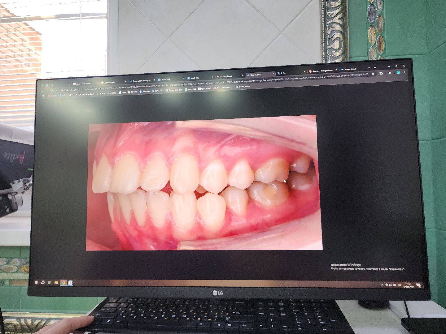 вертикакли, стоматология, медицина, красногорск,