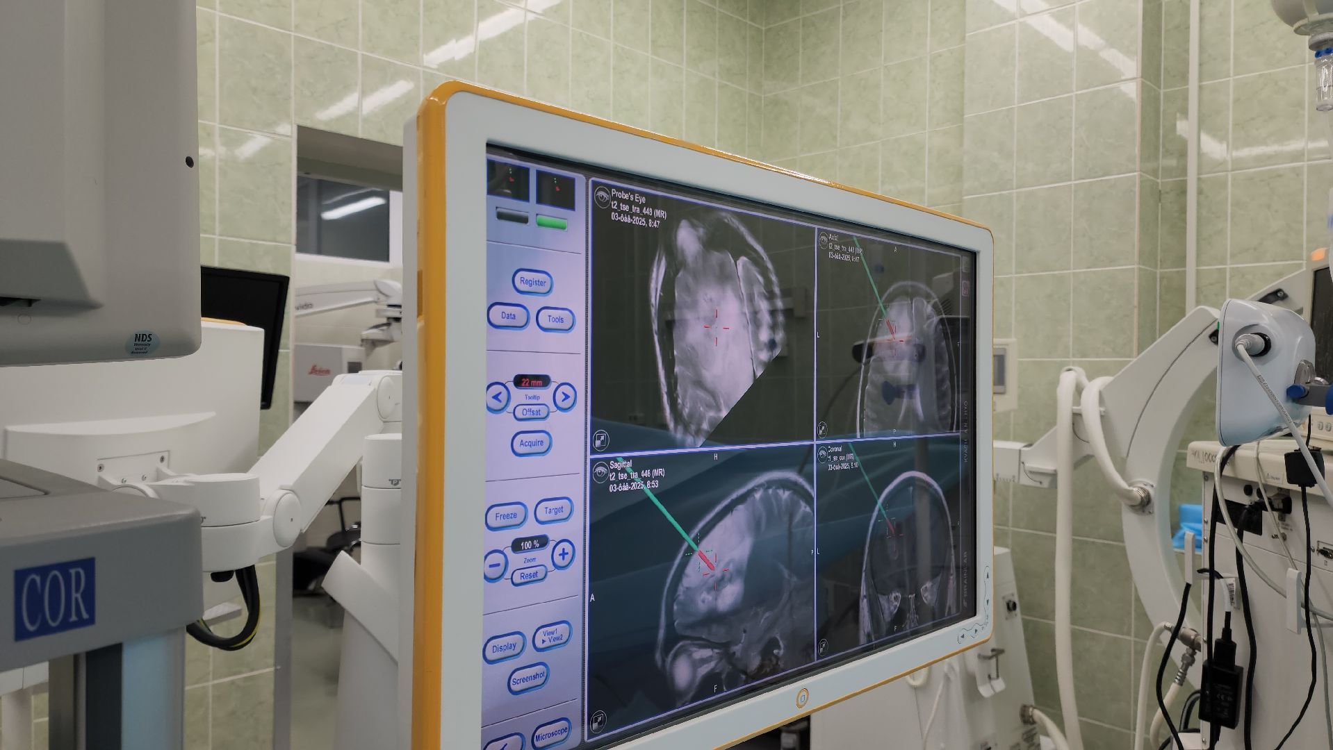 Подольск, нейрохирург, эпилепсия, медицина подмосковья, вертикалки,