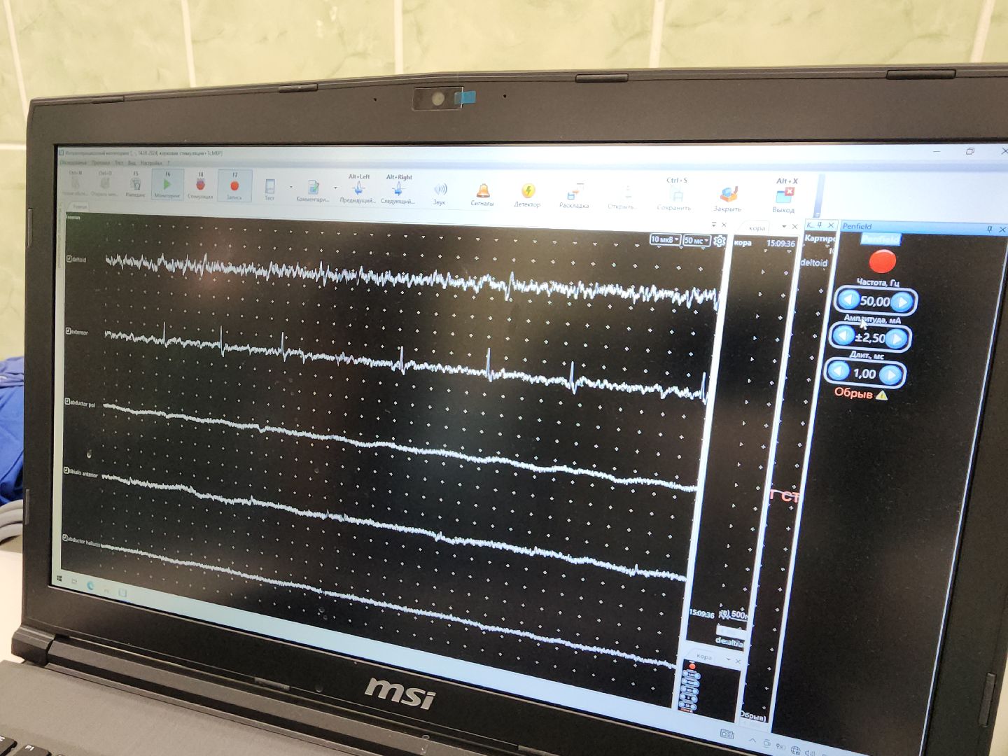 Подольск, нейрохирург, эпилепсия, медицина подмосковья, вертикалки,