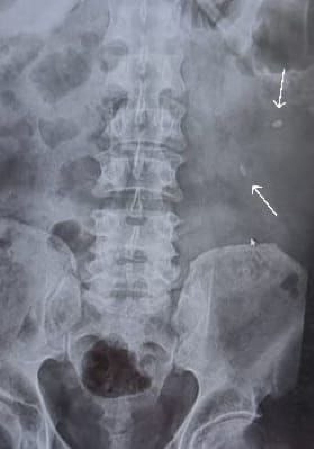 Жуковский, общество