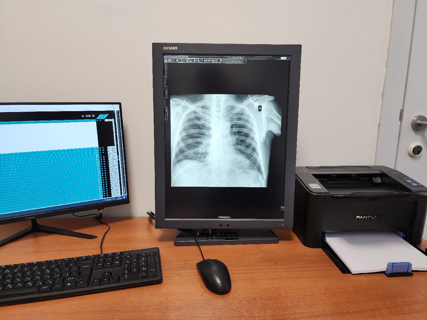 ногинск, медицина, новое оборудование, рентген-аппарат, больница,