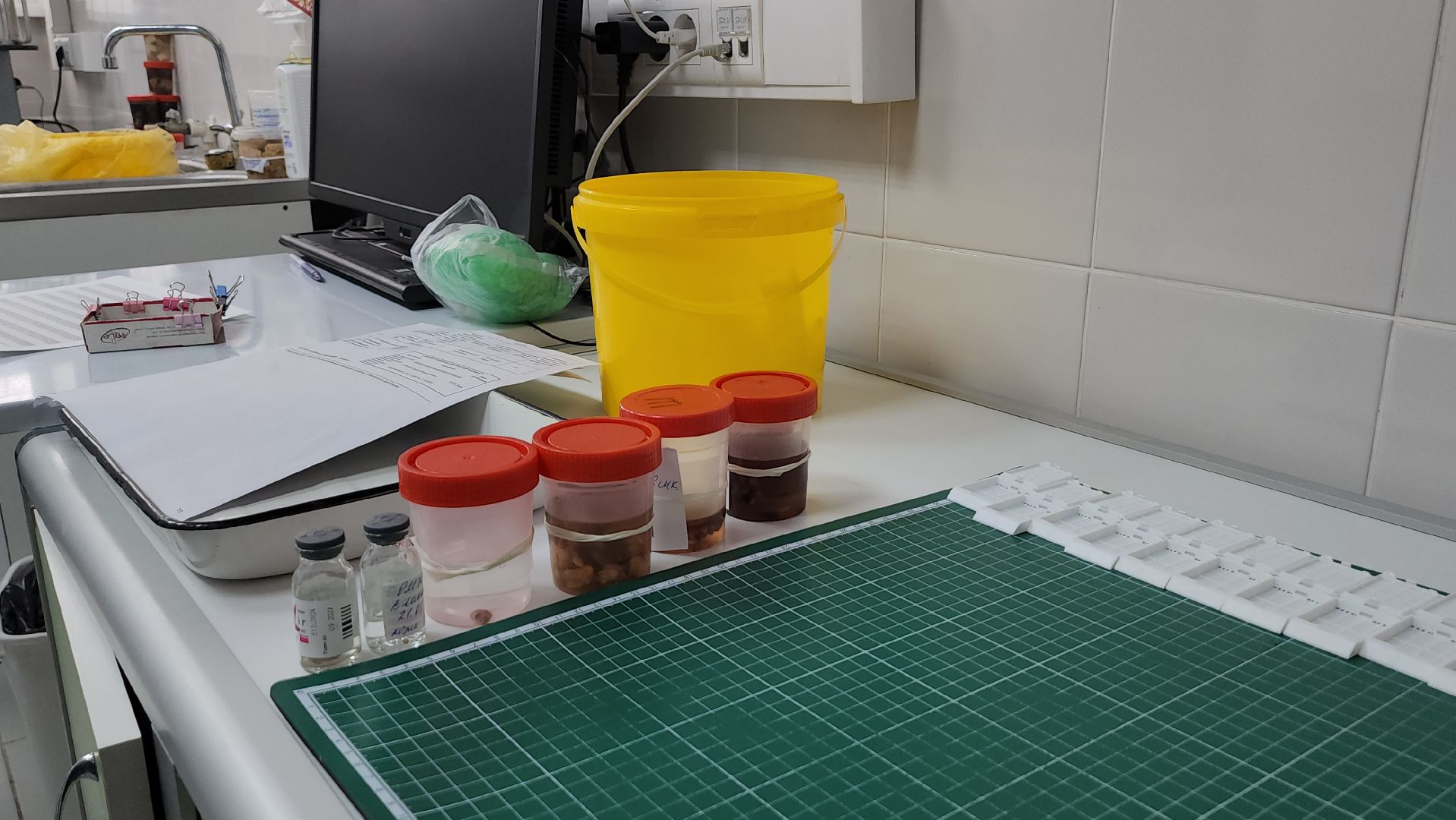 Люберцы, люберецкая областная больница, диагноз, новое оборудование,