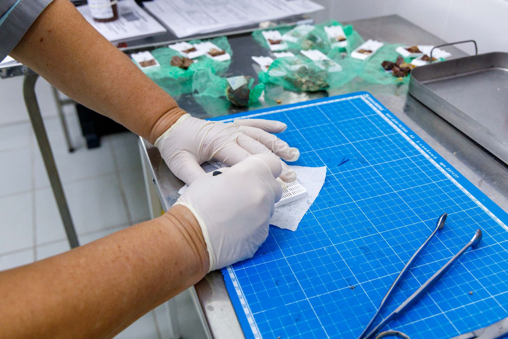 Люберцы, люберецкая областная больница, диагноз, новое оборудование,