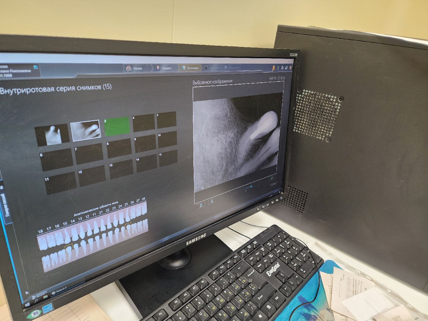 красноармейск, городской округ пушкинский, медсанчасть 154, вертикалки,