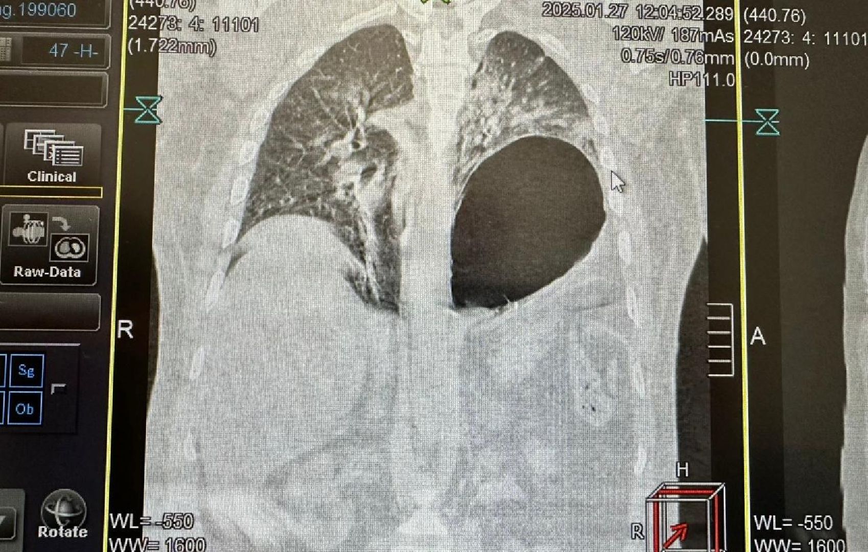 история спасения, хирургия, травма, вертикалки,