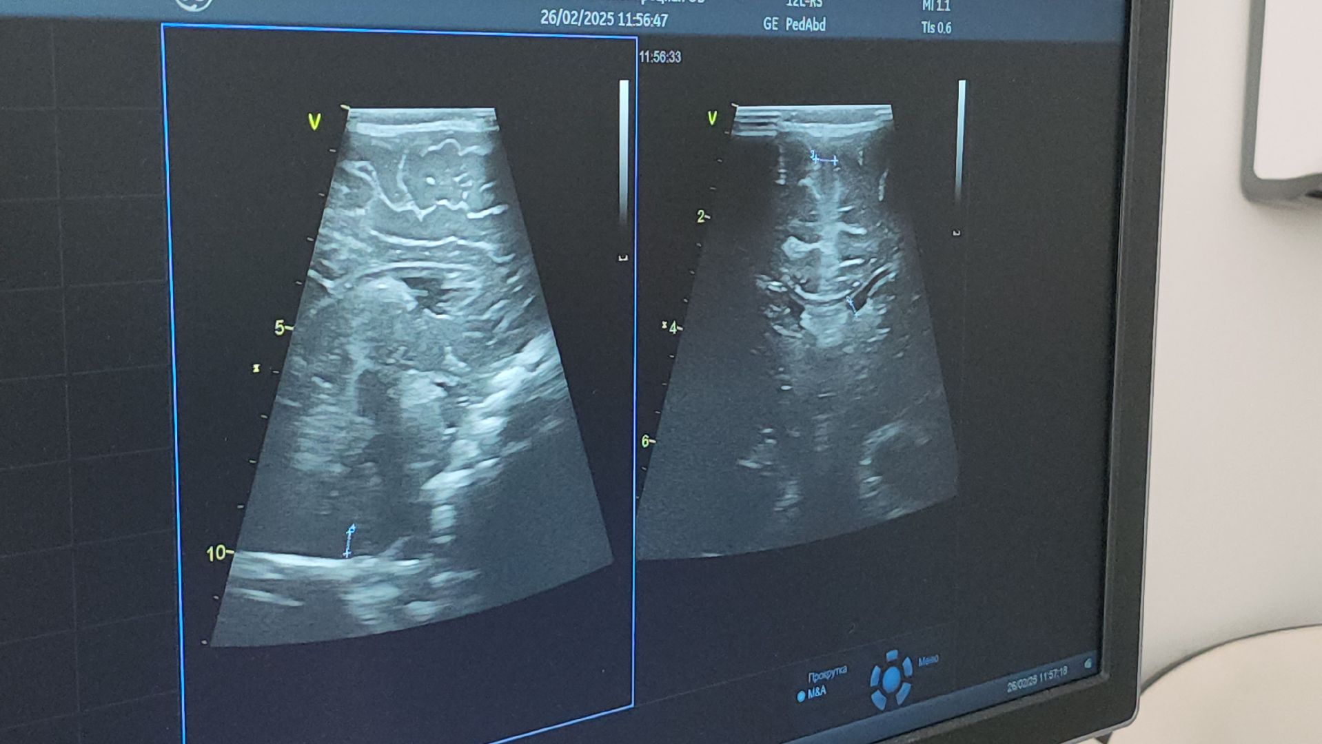 Люберцы, узи, новая поликлиника, новый врач,