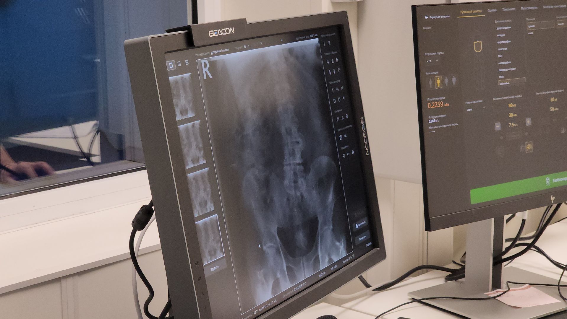 красногорск, медицина, рентген-аппарат,