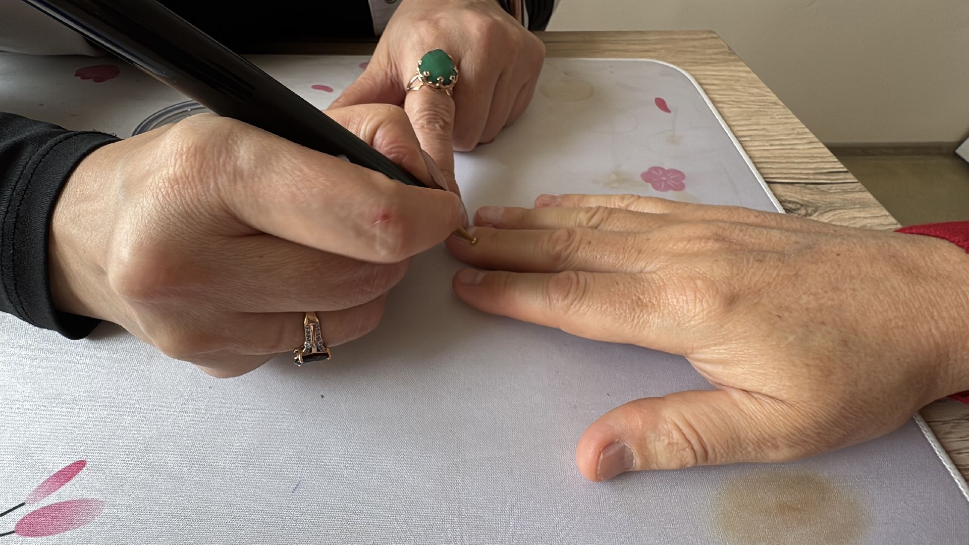 Центр интегративной медицины, Минздрав МО, Лечение боли,