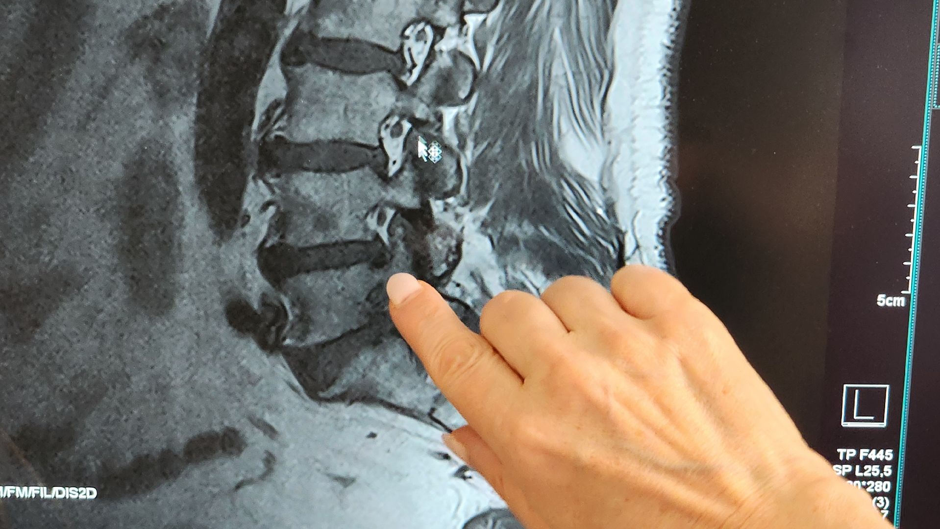 солнечногорск, медицина, тяжелое медицинское оборудование, мрт, поликлиника,