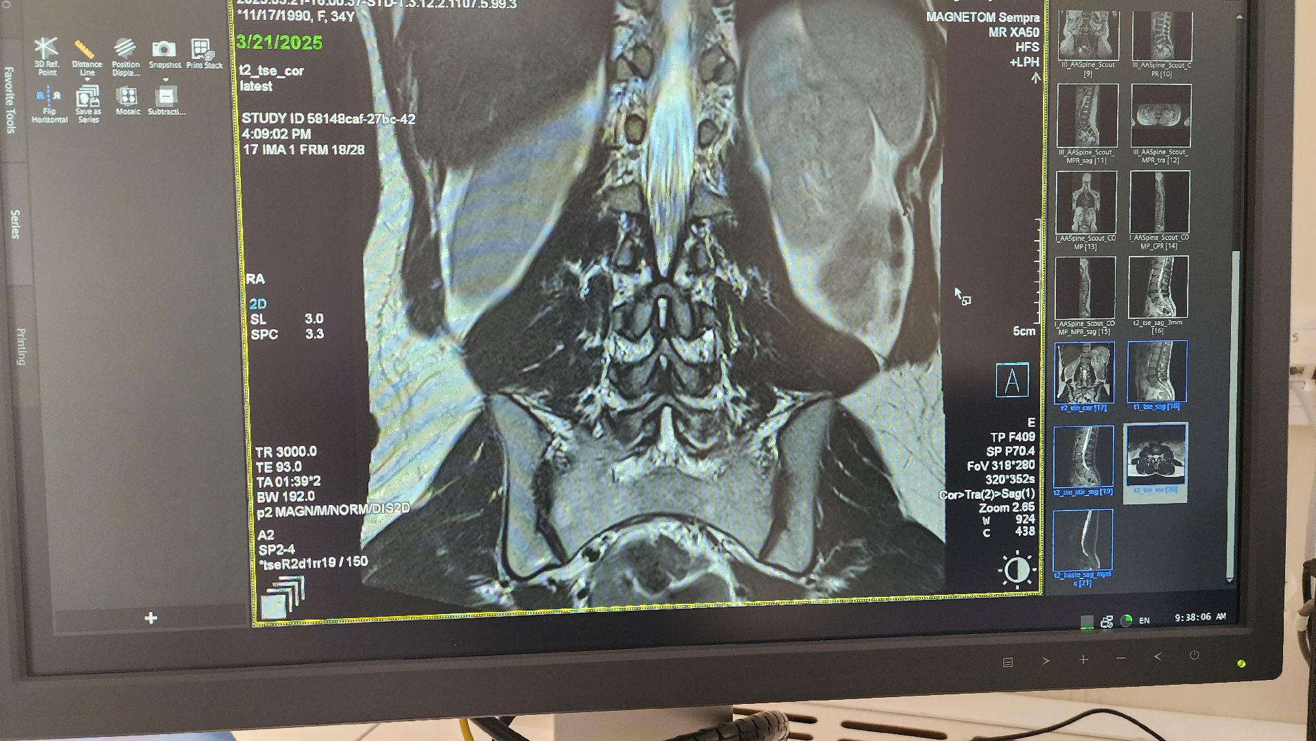 солнечногорск, медицина, тяжелое медицинское оборудование, мрт, поликлиника,