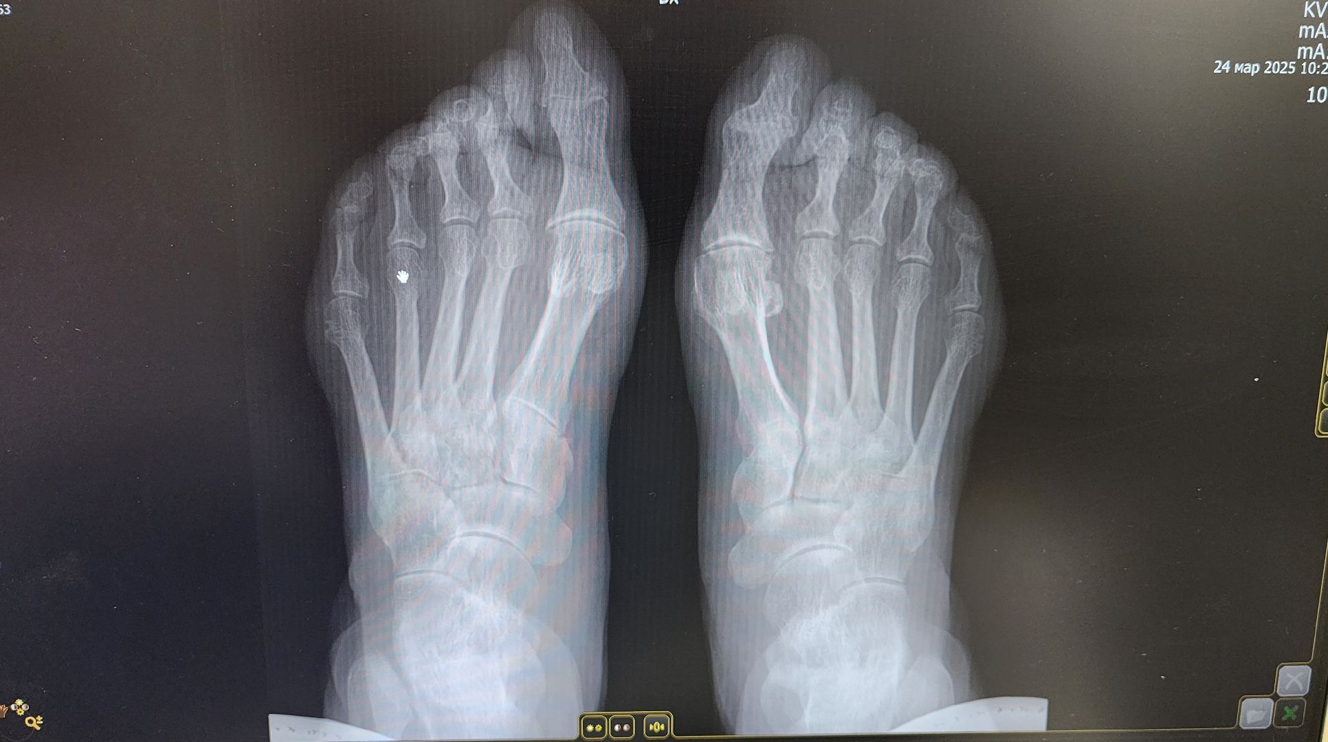 солнечногорск, медицина, рентген, тяжелое медицинское оборудование,