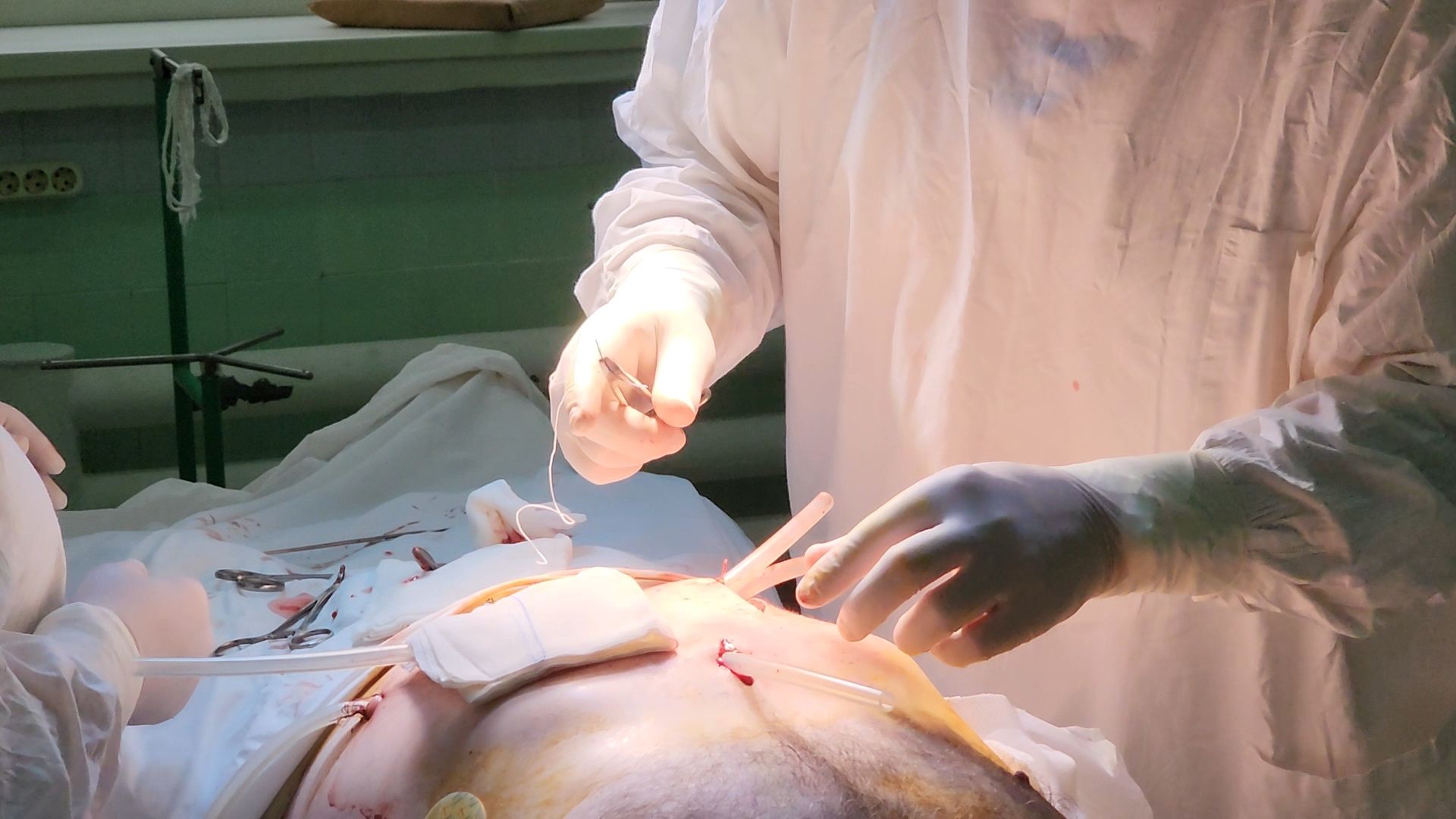 солнечногорск, операционный блок, наркоз, мед оборудование,