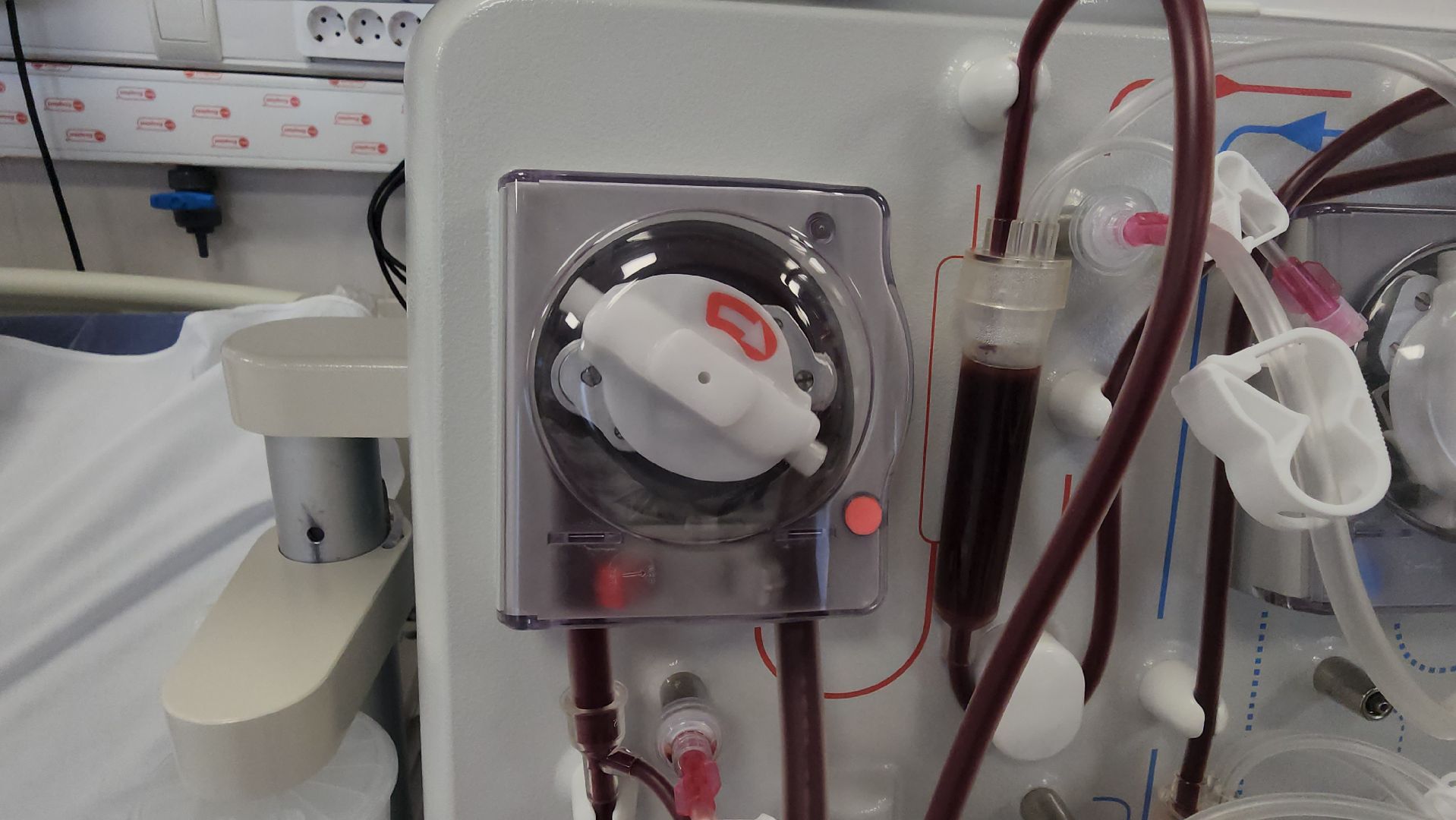 люберецкая больница, люберцы, врач-нефролог,гемодиализ,