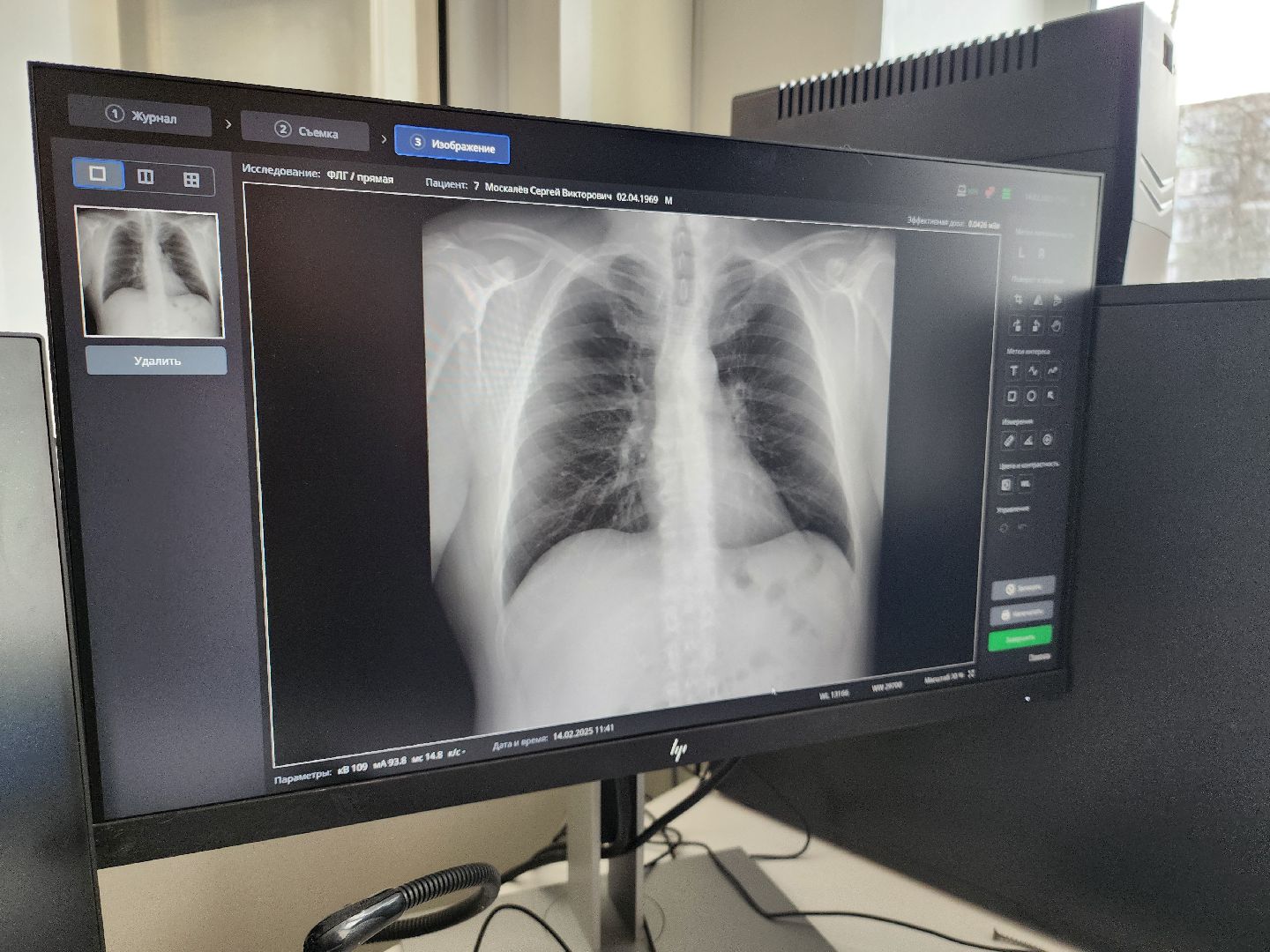 Зарайск, Здравоохранение, Новый кабинет флюорографии, Новый аппарат флюорографии в Зарайске,