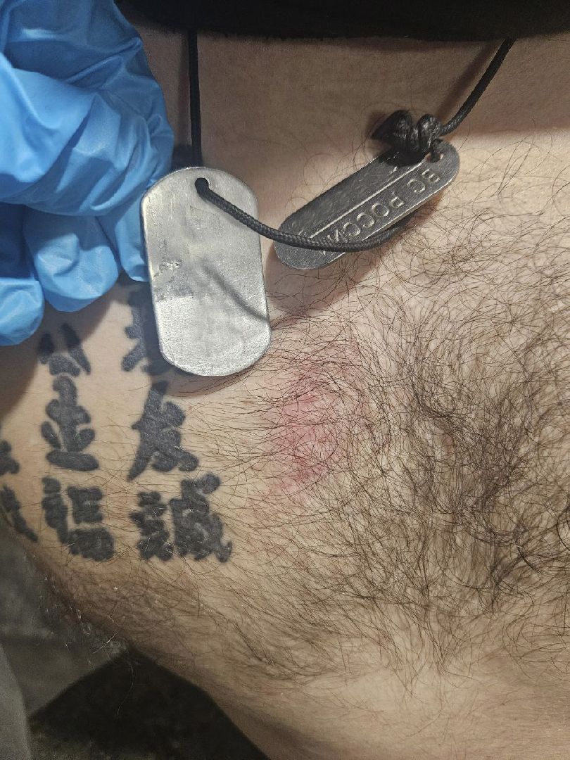 спецоперация, врач, контрактная служба,