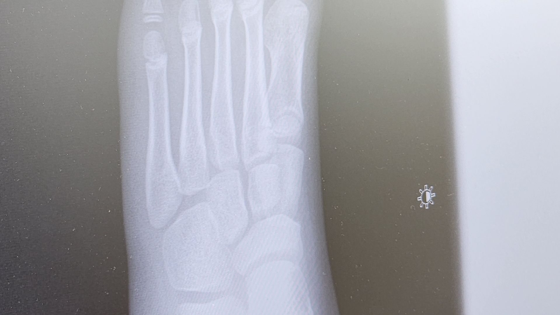 солнечногорск, детская поликлиника, медицина, травмотология,