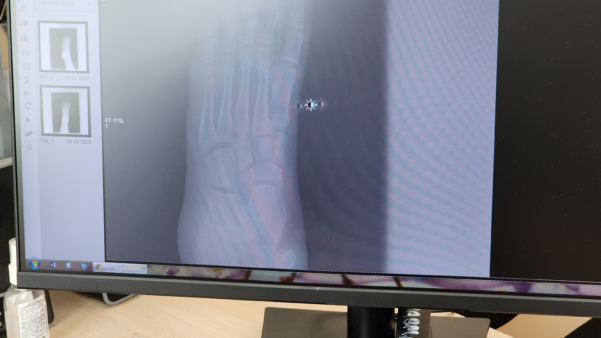 солнечногорск, детская поликлиника, медицина, травмотология,