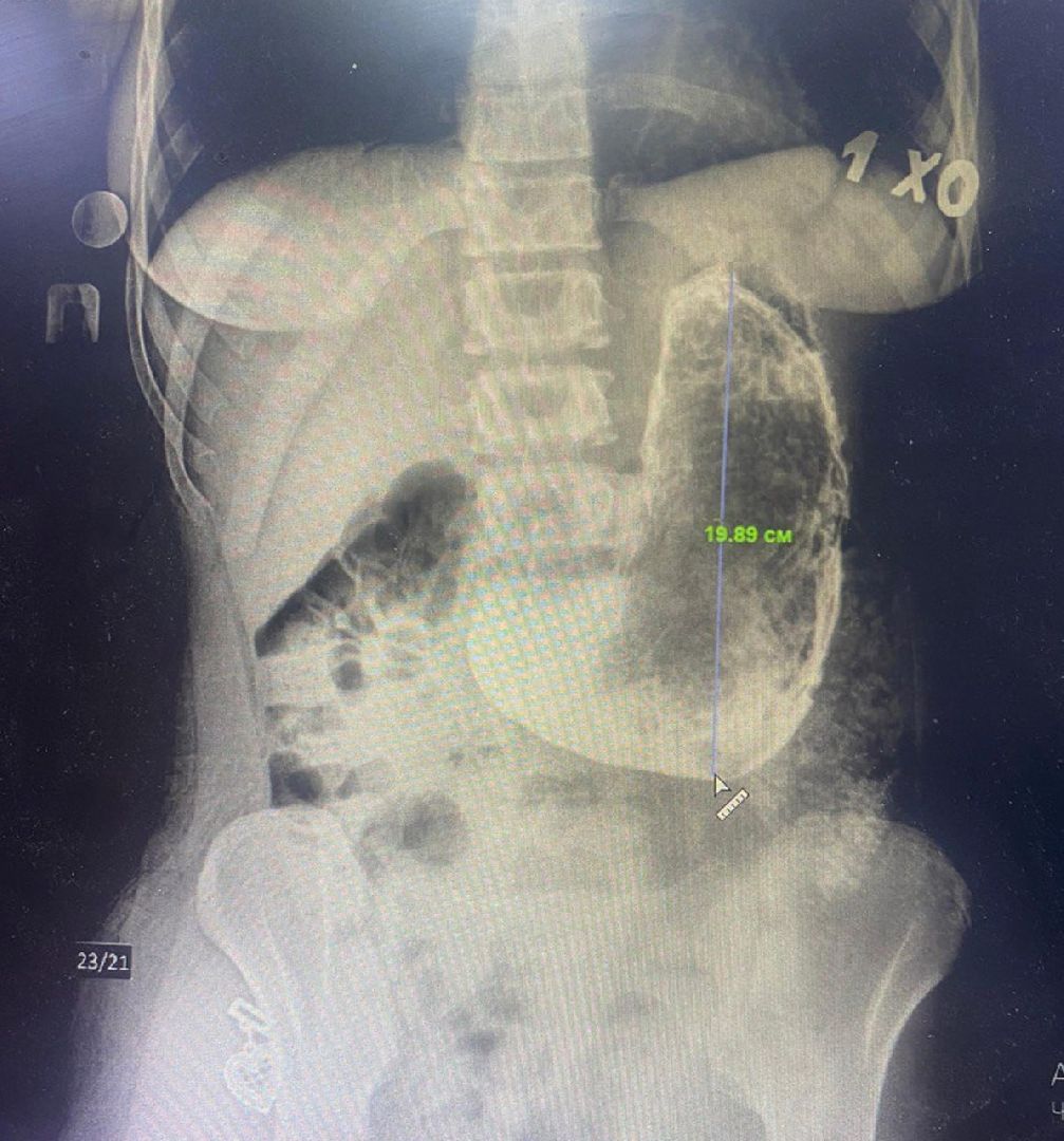 красногорск, медицина, операция,