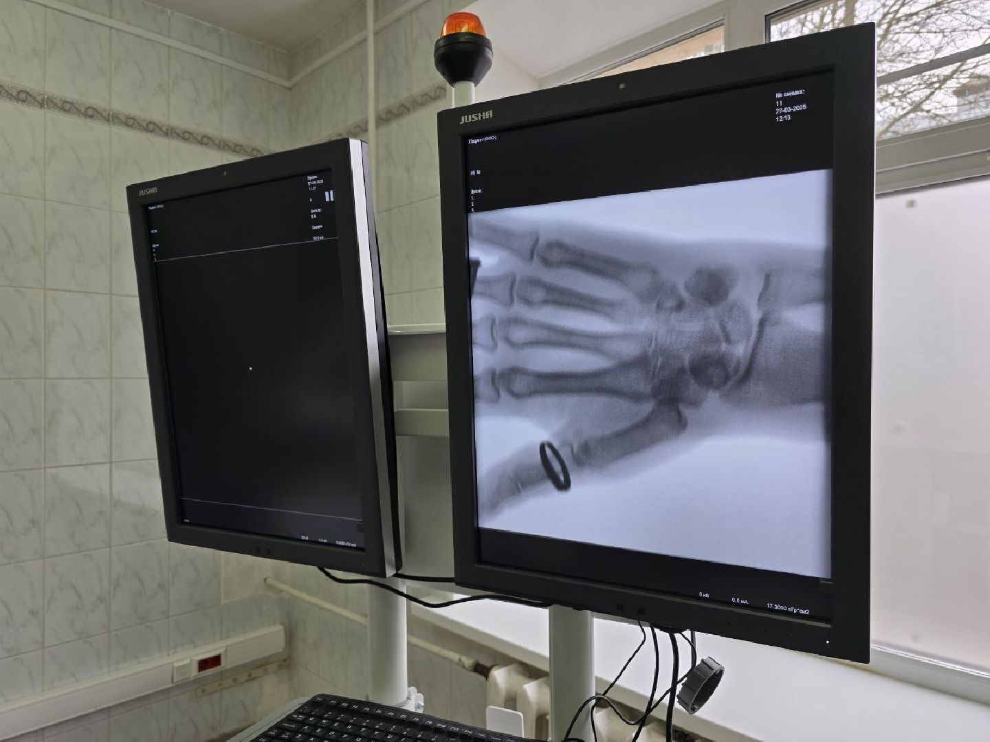 можайск, можайский муниципальный округ, новое оборудование, медицина, здравоохранение, здравоохранение мо, рентгенохирургическая система С-дуга,