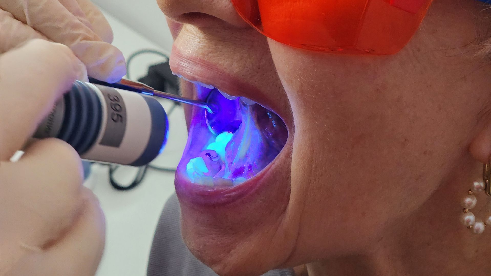 солнечногорск, стоматология, онкоскрининг полости рта, активное долголетие,