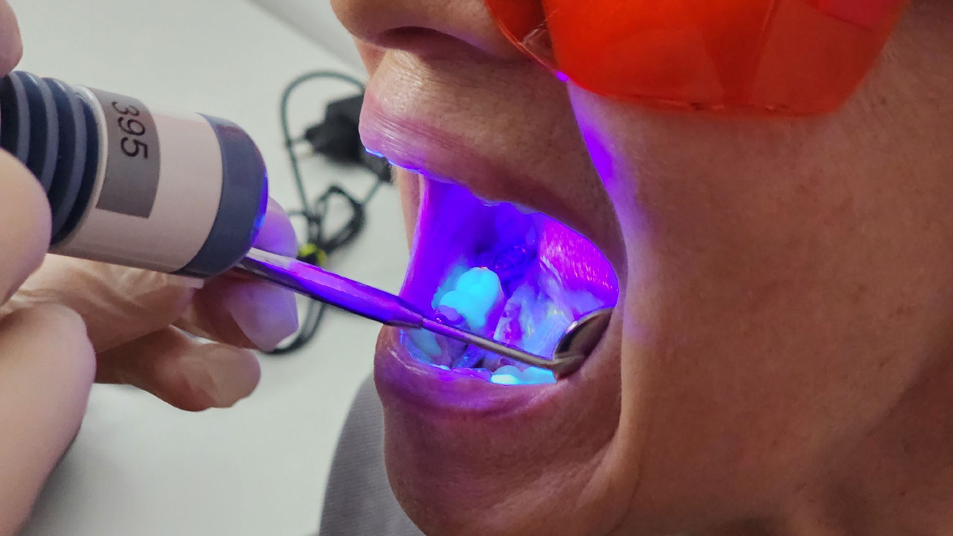 солнечногорск, стоматология, онкоскрининг полости рта, активное долголетие,