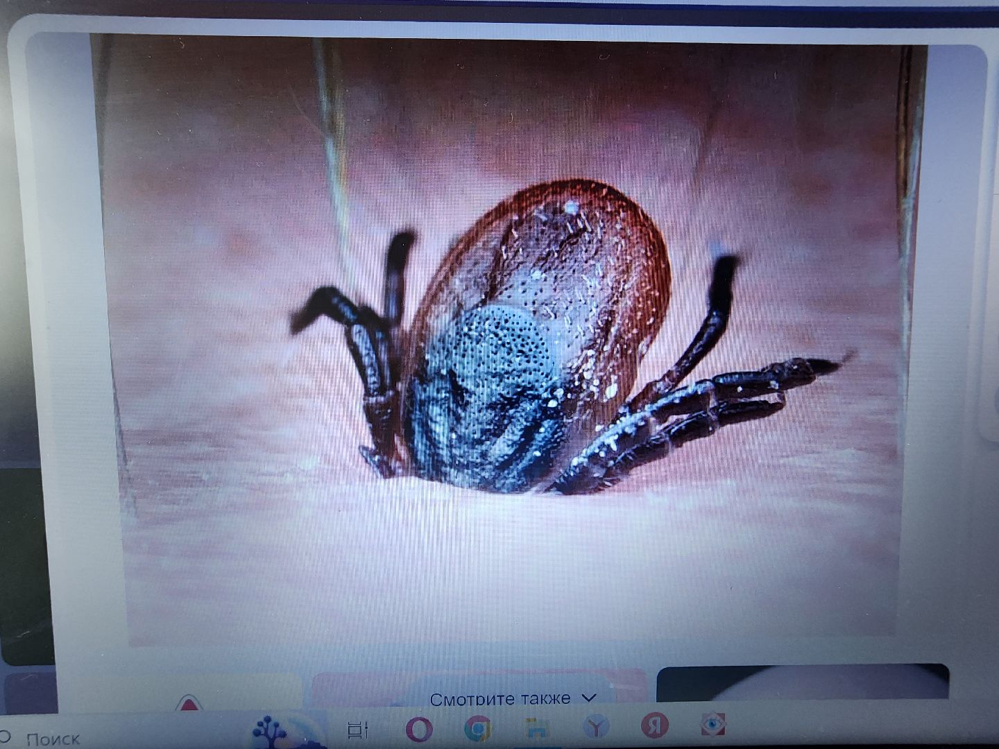 фрязино, клещи, боррелиоз, эпидемиолог,