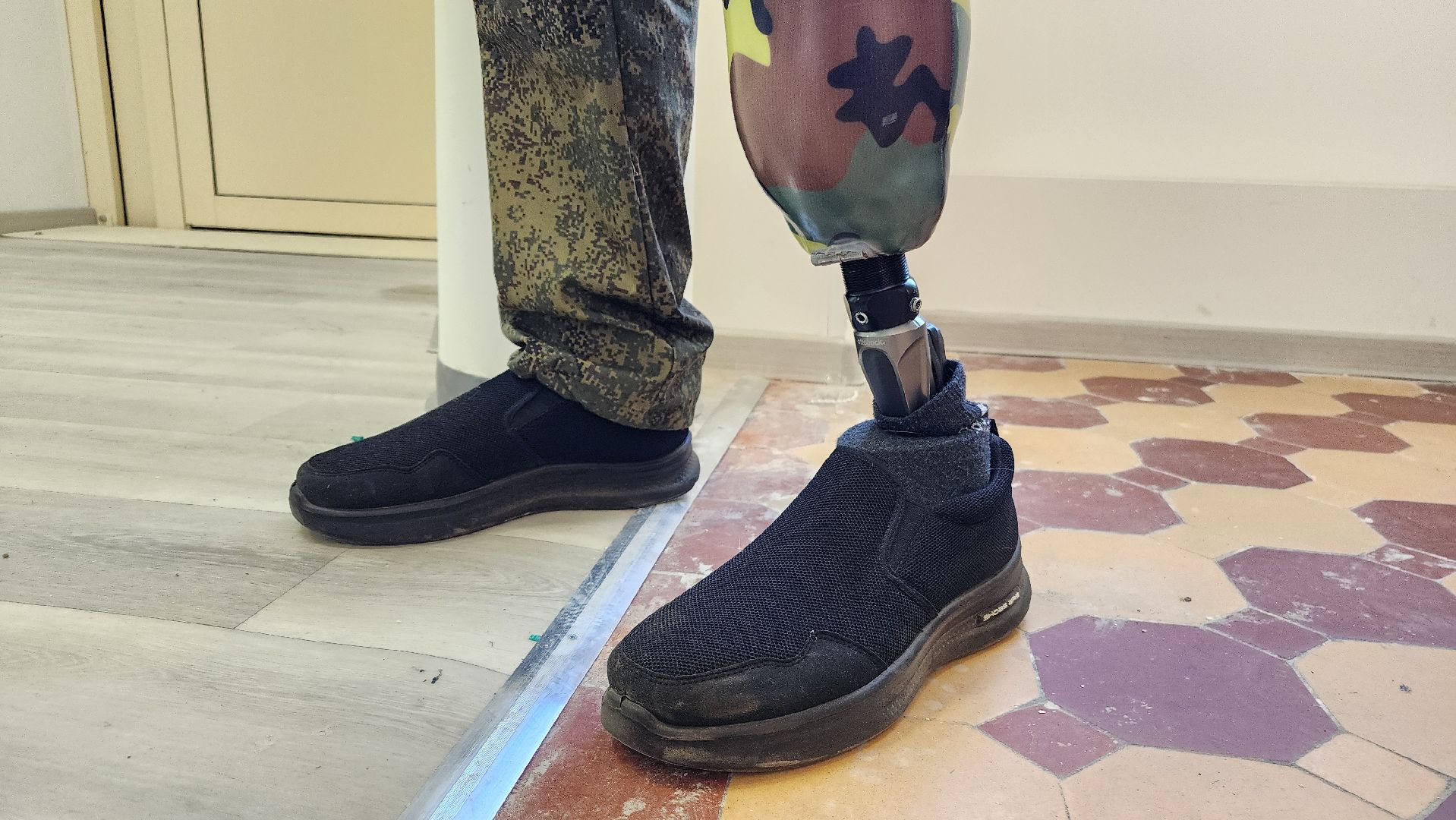 фрязино, протезирование, сво, медицина,