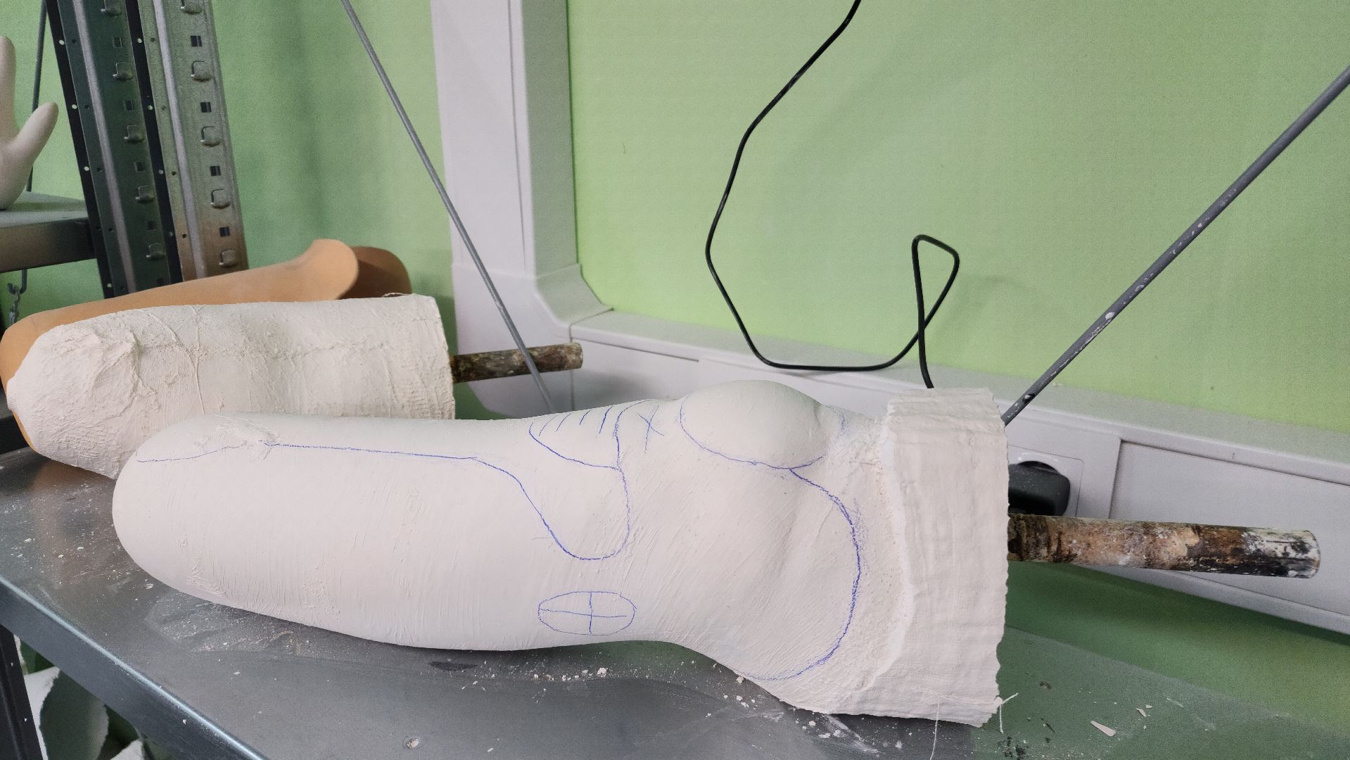 фрязино, протезирование, сво, медицина,