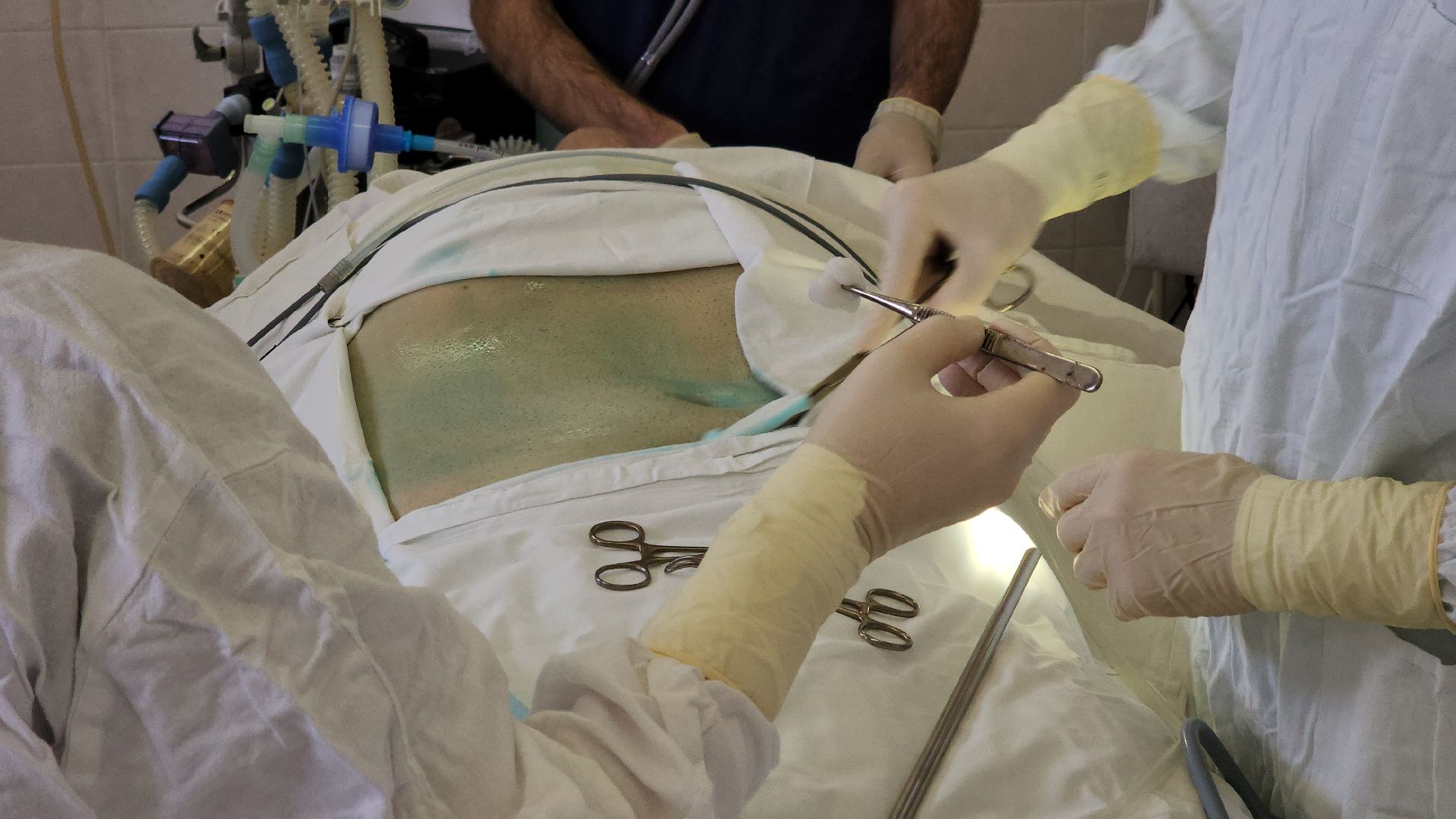 кашира, медицина, хирургия, операция, каширская больница, здоровье,