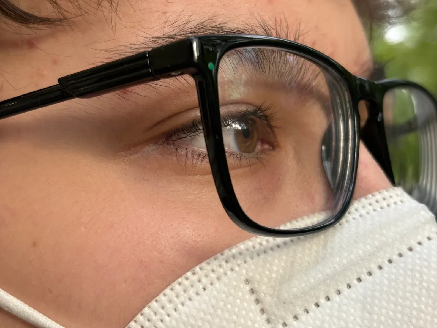 шаховская, пыльца березы, аллергия, аллерголог,