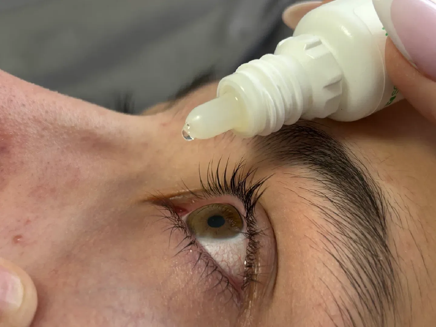 шаховская, пыльца березы, аллергия, аллерголог,