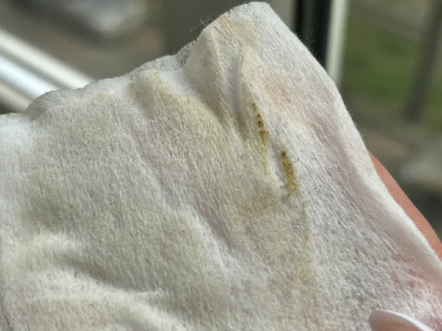 шаховская, пыльца березы, аллергия, аллерголог,