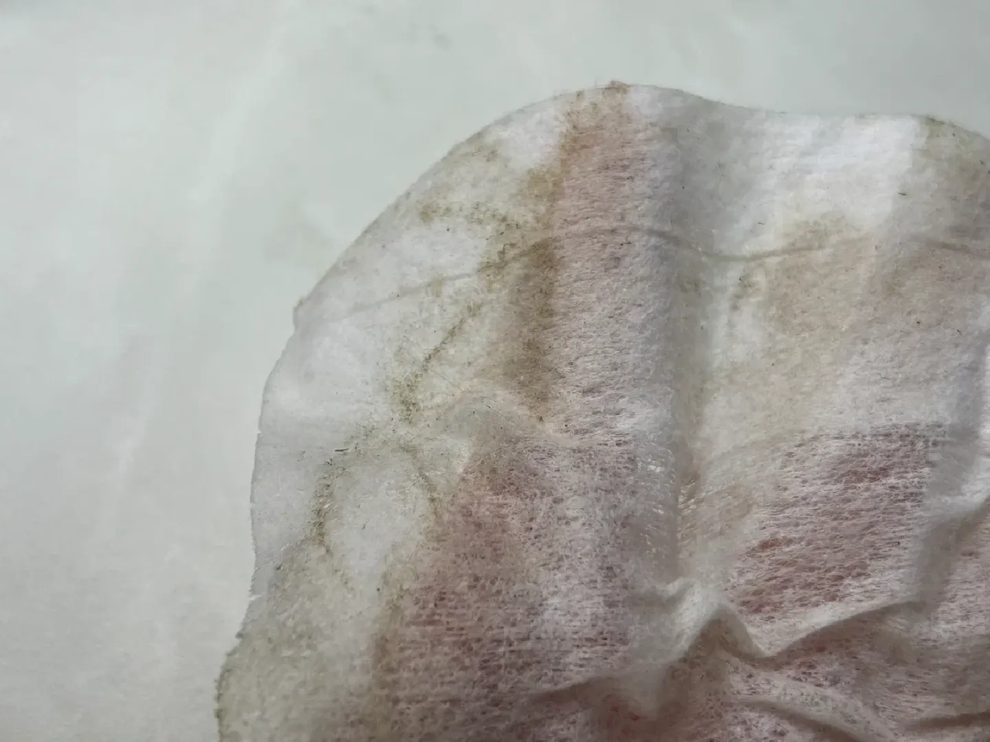 шаховская, пыльца березы, аллергия, аллерголог,