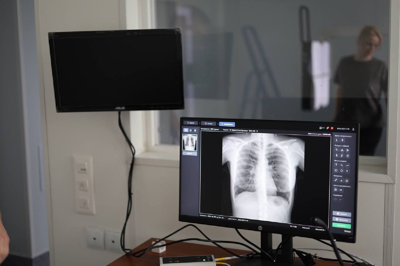 электросталь, медицина, больница, общетво, новое оборудование, флюорограф,