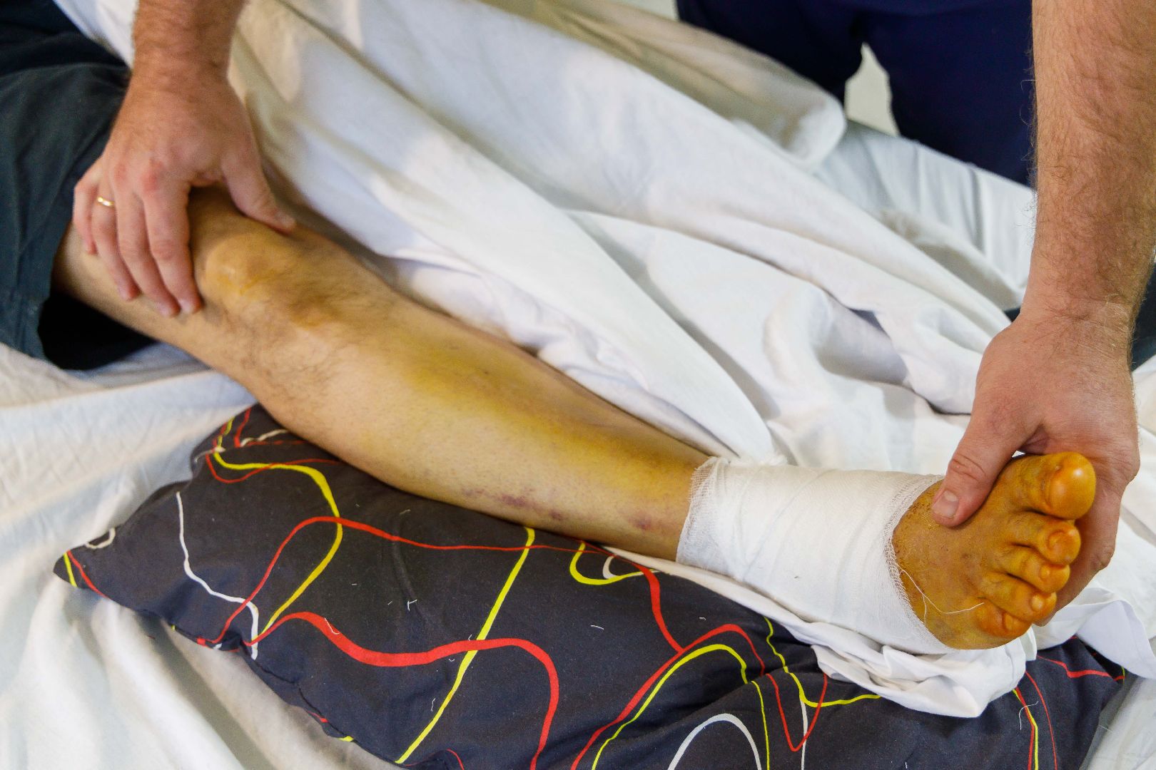 Люберецкая  областная больница, врач-травматолог, профессиональный праздник, пациенты, операции, остеосинтез,