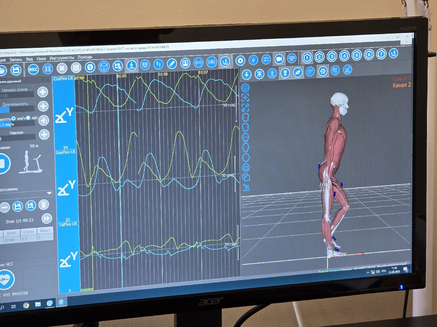 Коломна, реабилитация участников сво, реабилитационный центр,