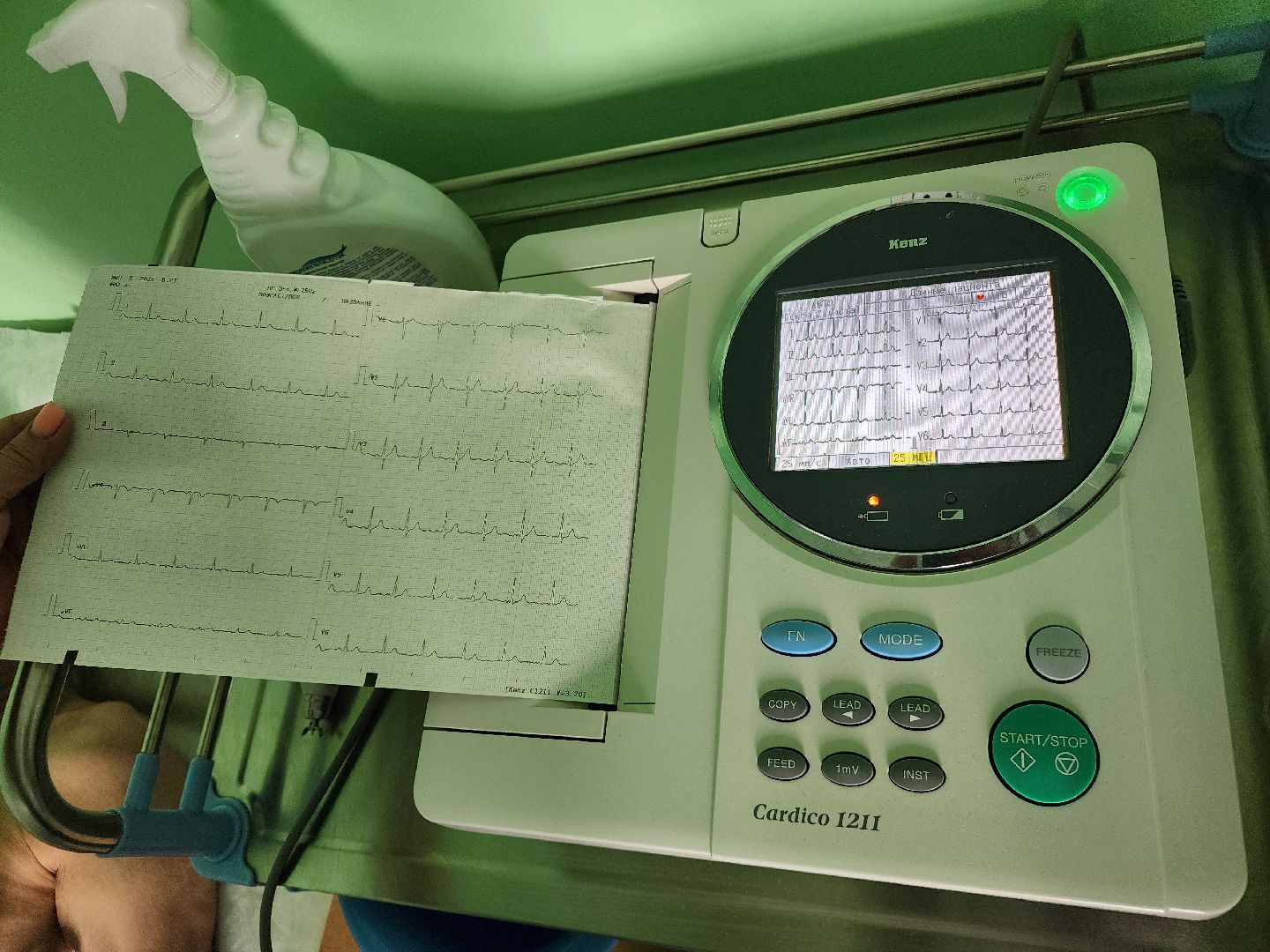 Подольск , Сердечный ритм, кардиолог,