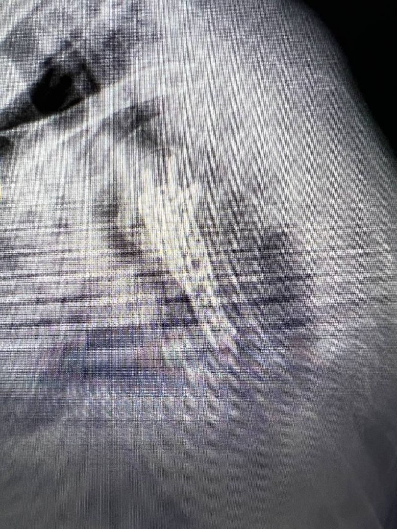 Подольск, Медицина, Лечение переломов, Траматолог, врачи подмосковья, покб,