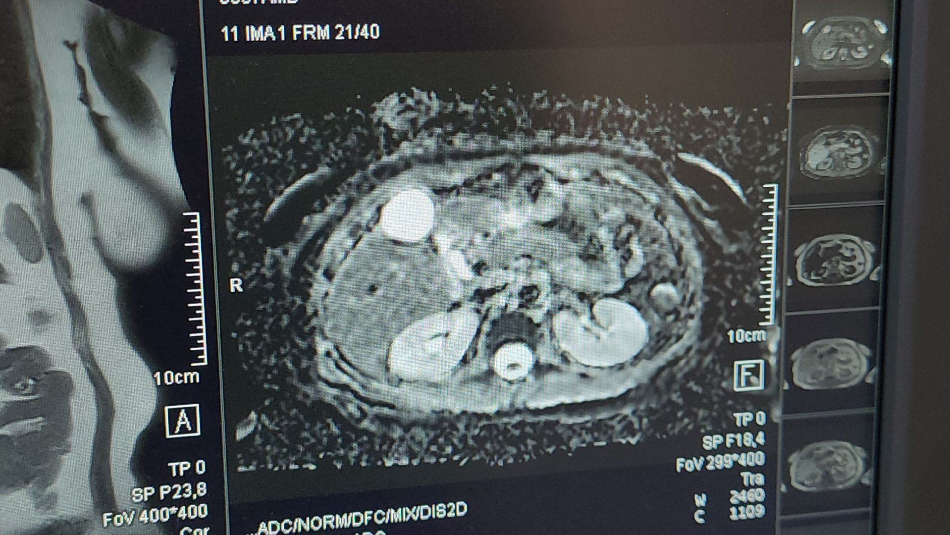 Истра, мрт, Медицина ,